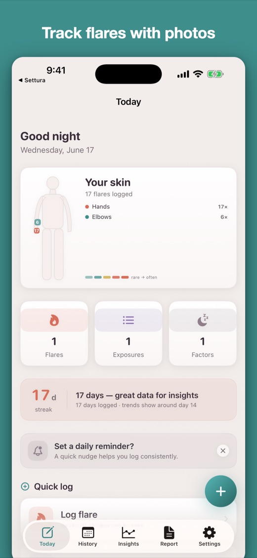 NerveLog for iPhone — home screen
