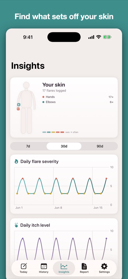 NerveLog for iPhone — logging